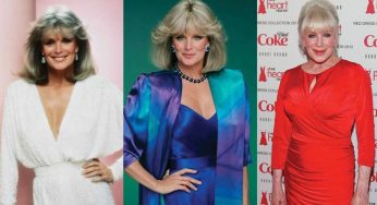 Linda Evans Plastic Surgery