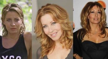 Linda Kozlowski Plastic Surgery