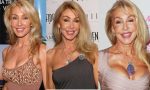 Linda Thompson Plastic Surgery