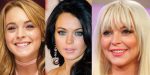 Lindsay Lohan Plastic Surgery