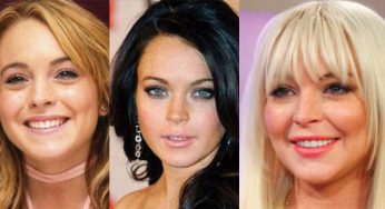 Lindsay Lohan Plastic Surgery