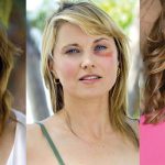 Lucy Lawless Plastic Surgery