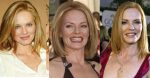 Marg Helgenberger Plastic Surgery