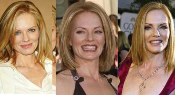Marg Helgenberger Plastic Surgery
