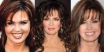 Marie Osmond Plastic Surgery