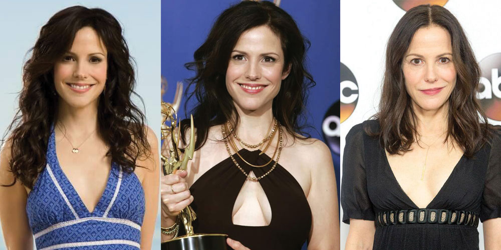 Mary Louise Parker Plastic Surgery Before and After 2024