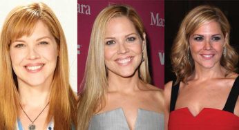 Mary Mccormack Plastic Surgery