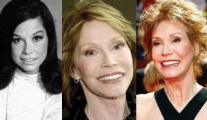 mary tyler moore plastic surgery