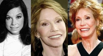 Mary Tyler Moore Plastic Surgery