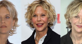 Meg Ryan Plastic Surgery