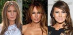 Melania Trump Plastic Surgery