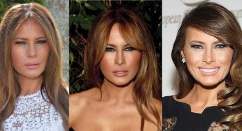 Melania Trump Plastic Surgery