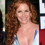 Melissa Gilbert Plastic Surgery