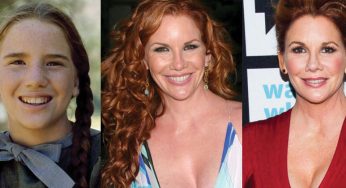 Melissa Gilbert Plastic Surgery