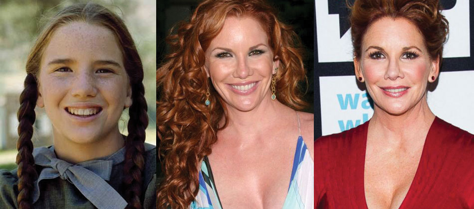 Melissa gilbert breasts