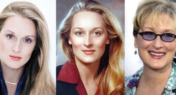 Meryl Streep Plastic Surgery