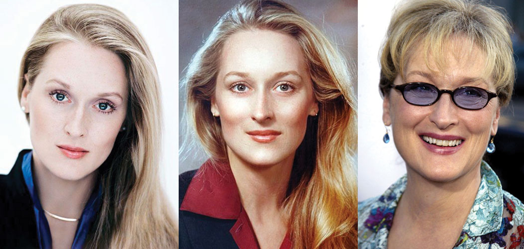 Meryl Streep Plastic Surgery Before and After 2023