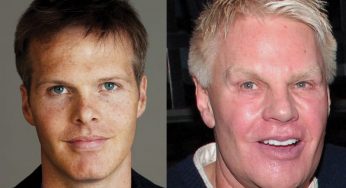 Mike Jeffries Plastic Surgery
