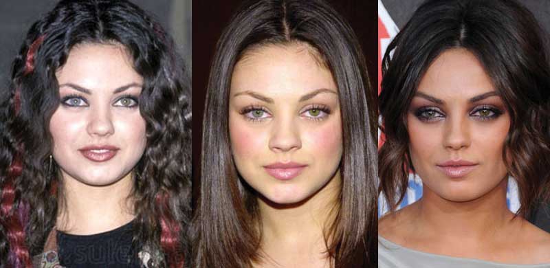 mila kunis plastic surgery