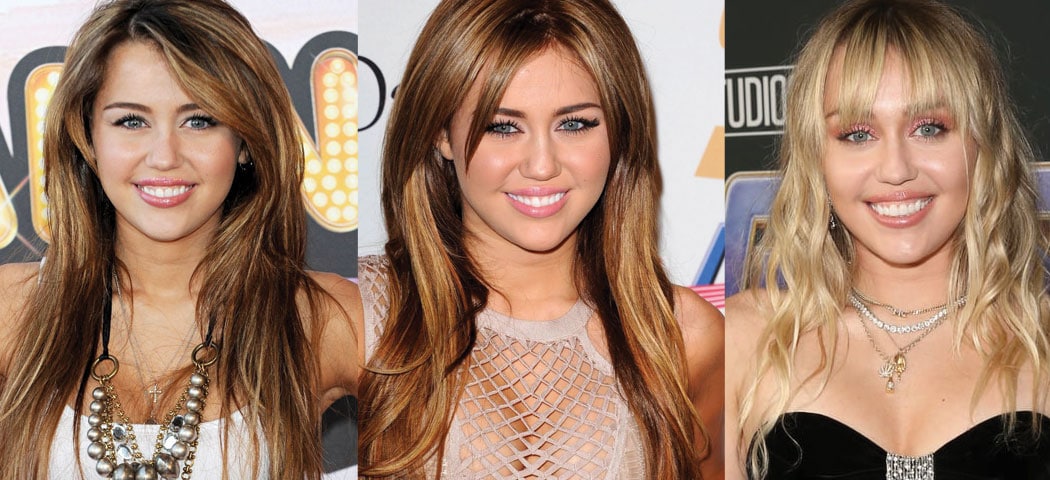 Miley Cyrus Plastic Surgery Before and After 2023