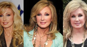 Morgan Fairchild Plastic Surgery