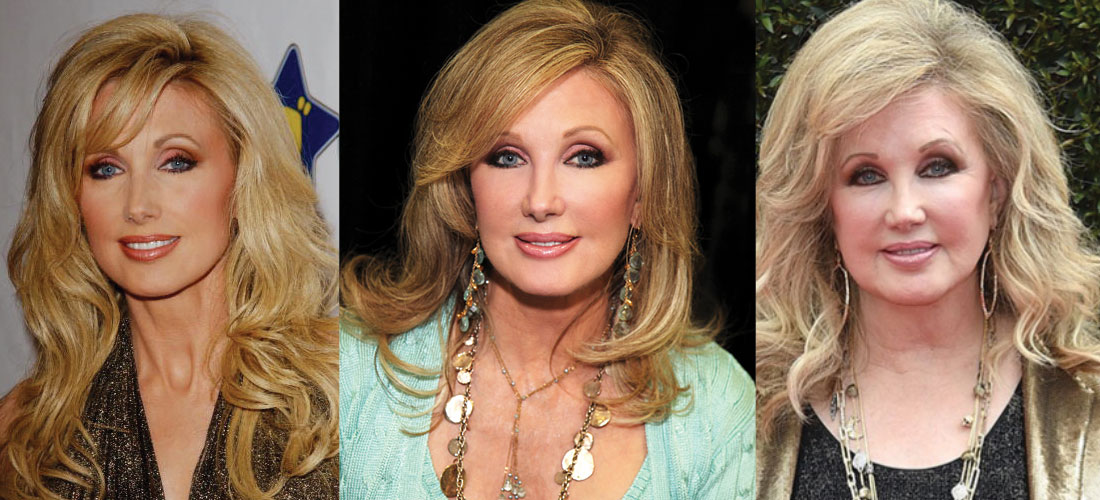 Morgan Fairchild Plastic Surgery Before and After 2023