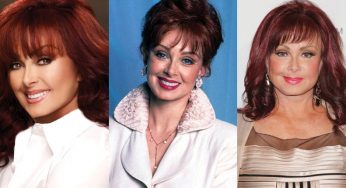 Naomi Judd Plastic Surgery