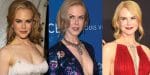 Nicole Kidman Plastic Surgery Before and After Pictures 2025