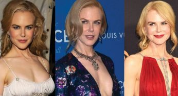 Nicole Kidman Plastic Surgery