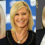 Olivia Newton John Plastic Surgery