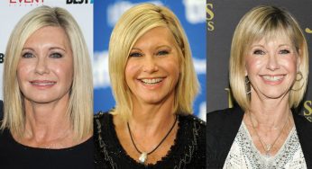 Olivia Newton John Plastic Surgery