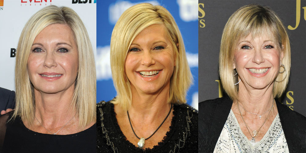 Olivia Newton John Plastic Surgery Before and After 2023