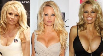 Pamela Anderson Plastic Surgery