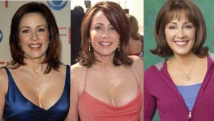 patricia heaton plastic surgery