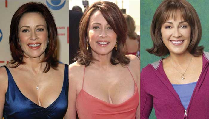 Patricia Heaton Plastic Surgery Before and After 2022