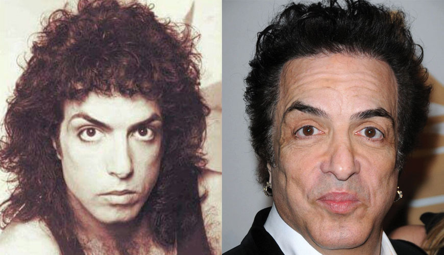 Paul Stanley Plastic Surgery Before and After 2022