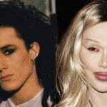 Pete Burns Plastic Surgery