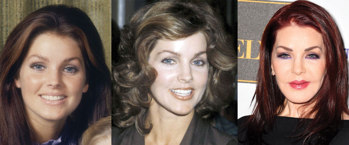 Priscilla Presley Plastic Surgery Before And After Pictures 2022.