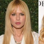 Rachel Zoe Plastic Surgery