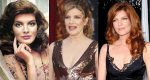 Rene Russo Plastic Surgery