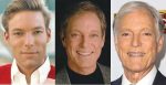 Richard Chamberlain Plastic Surgery