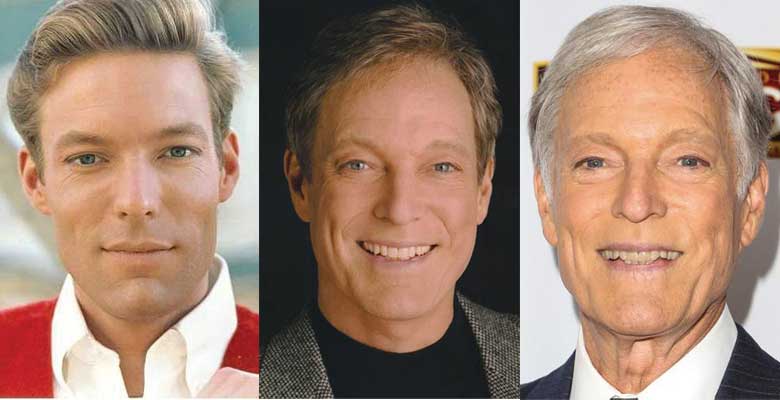 Richard Chamberlain Plastic Surgery Before and After Pictures 2020.