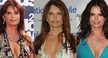 Roma Downey Plastic Surgery