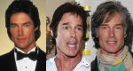 Ronn Moss Plastic Surgery