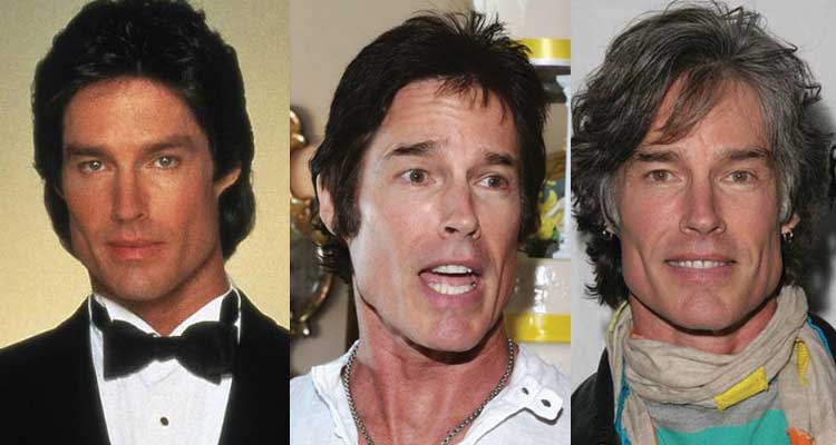 ronn moss plastic surgery