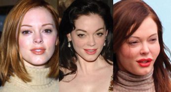 Rose McGowan Plastic Surgery