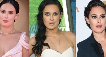 Rumer Willis Plastic Surgery