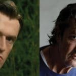 Rupert Everett Plastic Surgery