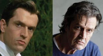 Rupert Everett Plastic Surgery