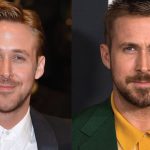 Ryan Gosling Plastic Surgery